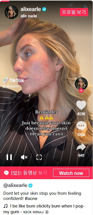 피부트러블도 콘텐츠가 된다.