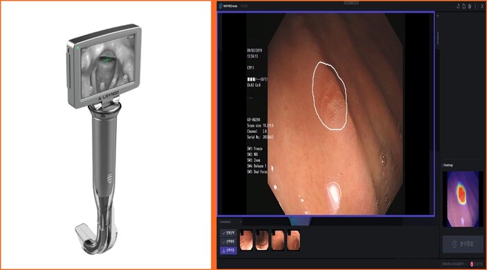 미국과 베트남 공공기관서 해외실증을 거치는 AI 기반 스마트 비디오 후두경(왼쪽)과 베트남서 실증하는 AI 내시경 영상 실시간 분석 및 암 발견·치료전략에 도움을 주는 의료기기. 사진=조달청